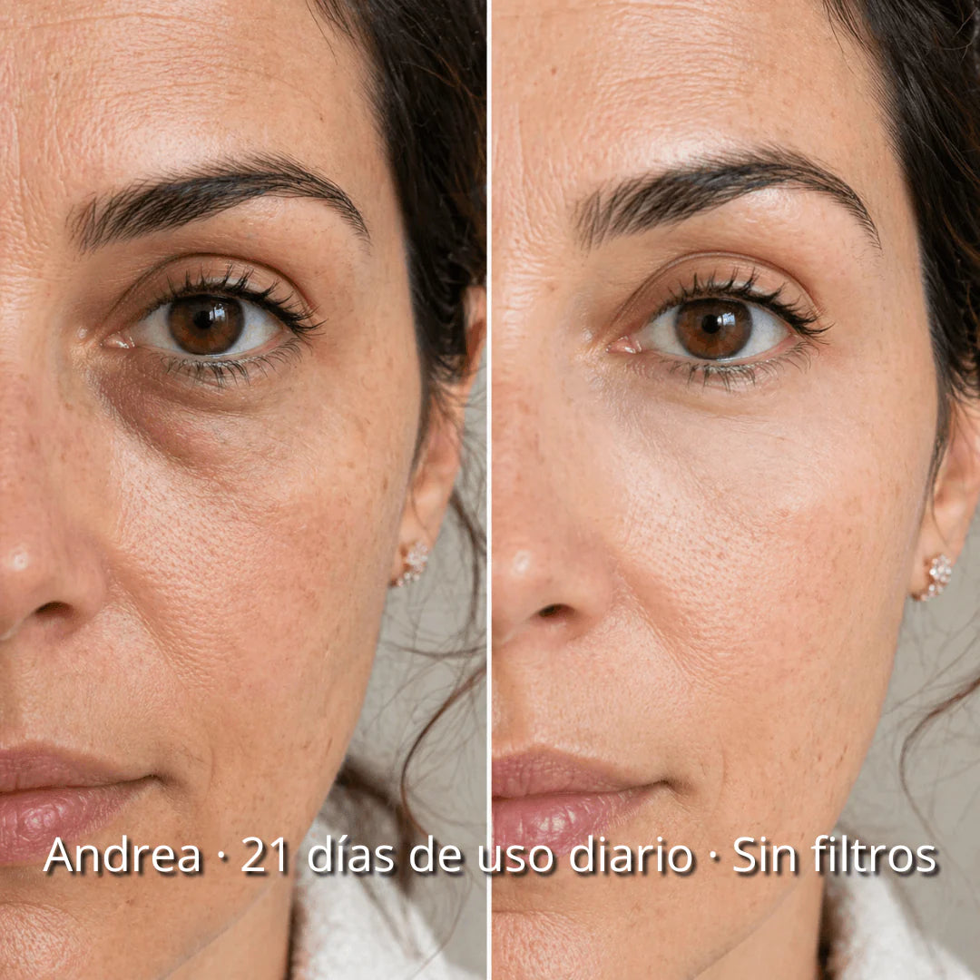 LumiLift Pro™ – Adiós a las ojeras y bolsas sin cremas ni trucos