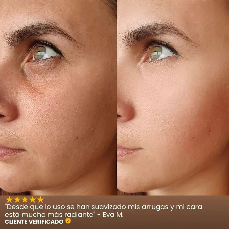 BEAUTY CREAM / INFIBELLA®️ - Reduce líneas de expresión y luce más joven